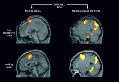 人类、动物与AI：跨越物种的意识探索